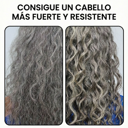 H18 - El Tratamiento de 4 Minutos